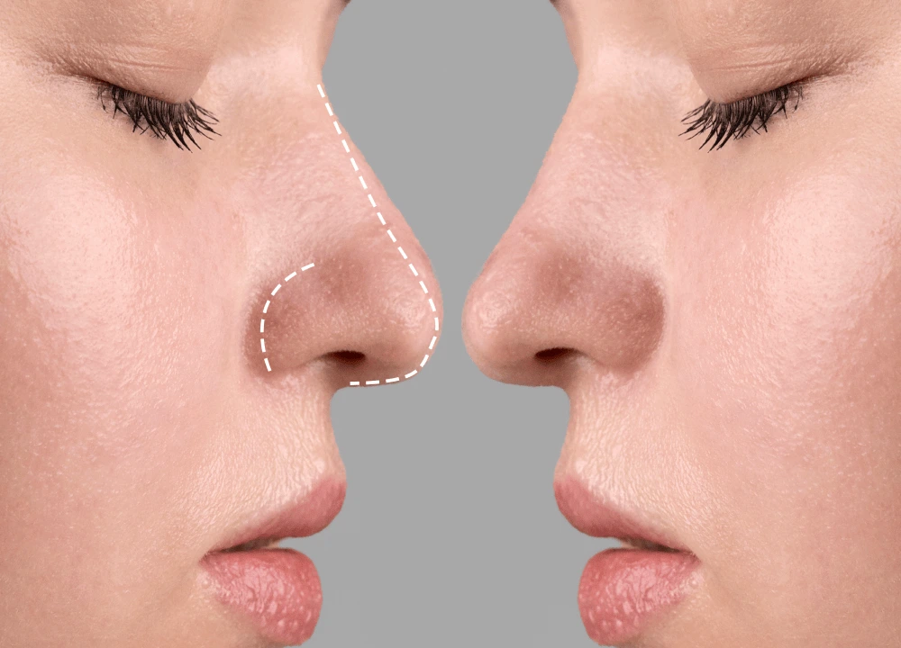 Covai Cosmetic Surgery